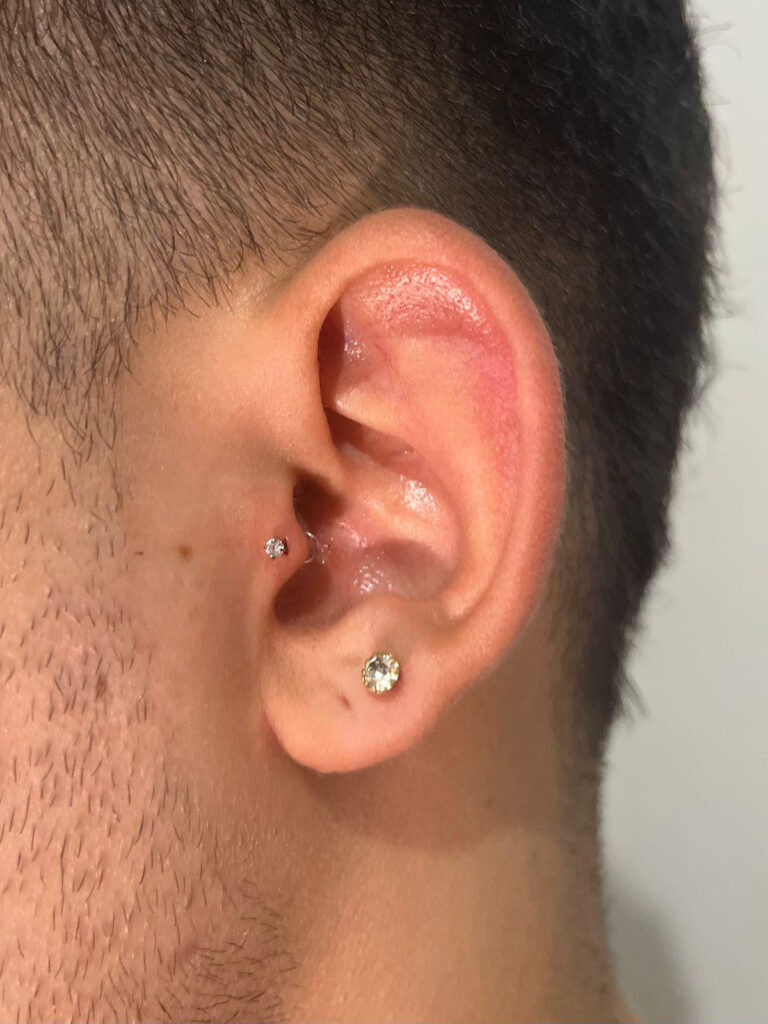 1AD96302-1C8B-45AB-8D94-ECACC3B311E6